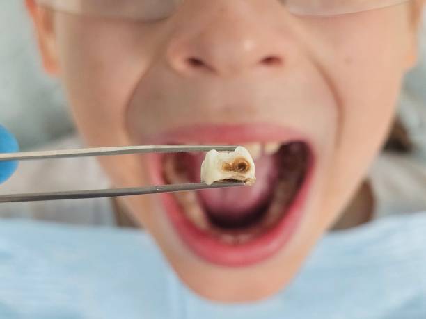 Best Emergency Dental Care for Sports Injuries in Goodwater, AL